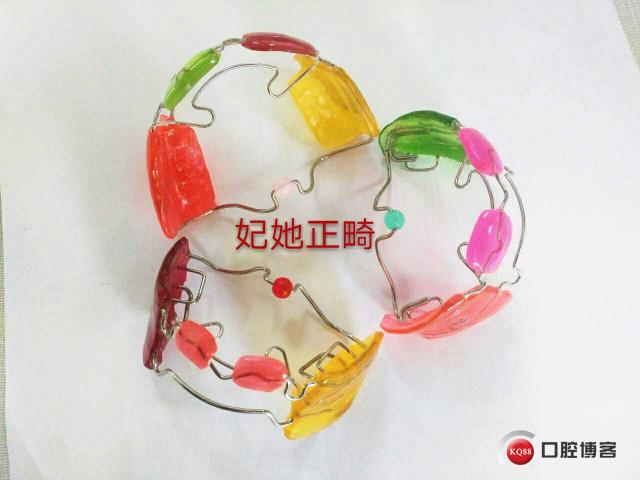 一种新型的fr3功能性矫治器