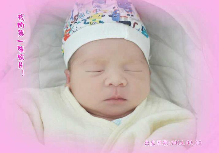 9.10宝宝出生2天多了