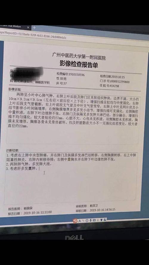 彷徨,爸爸64岁,15号咳血,进医院做ct结果是考虑中央型肺癌.-图1