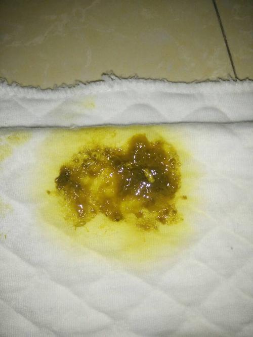 十天大的宝宝,拉这种便便正常么?有透明粘稠状物质.