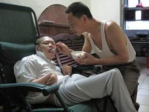 脑萎缩是一种危害极大的外科疾病,严重的小脑萎缩患者会渐渐失去记忆