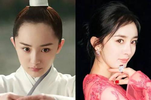 发量少,发际线后移还有救,快试试看!