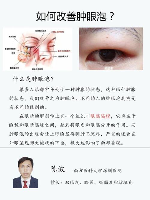 如何改善肿眼泡什么是肿眼泡呢