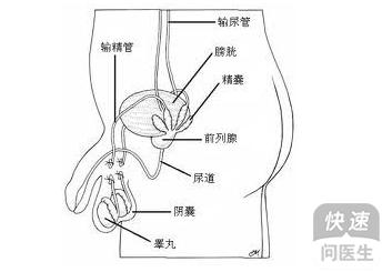 输精管堵塞的治疗方法有哪些