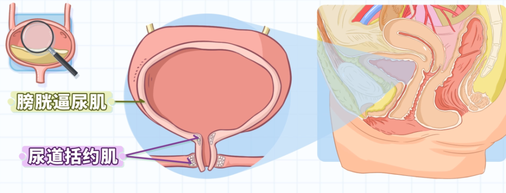 经常憋尿会引起膀胱炎?这次是真的!女性尤其要小心!