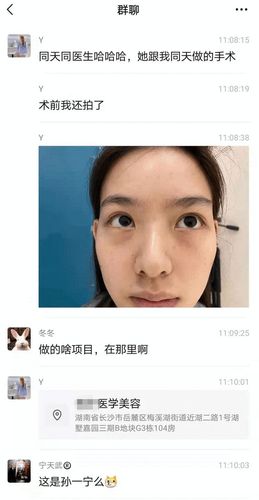 孙一宁直播至少赚50万,承认整容,称王思聪已将她拉黑