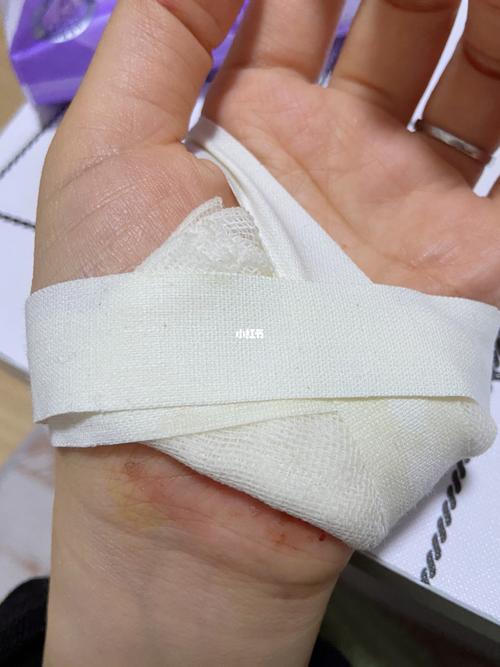 腿伤好的第三天,暴哭_护膝_医疗健康_医疗健康其他