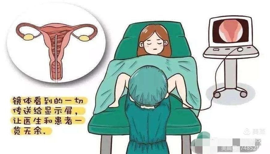 的微创性妇科诊疗技术,用于子宫腔内检查和治疗的一种纤维光源内窥镜