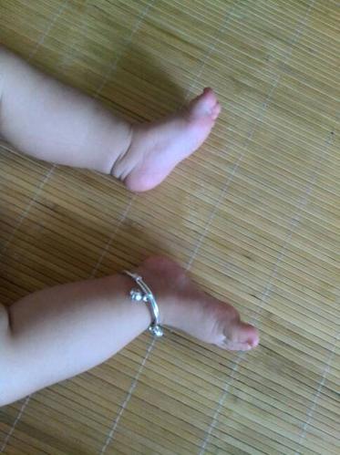 我家宝宝现在六个月大了,一直以来睡觉脚都往外翻,翻的很严重,请问