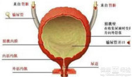 良性膀胱肿瘤的治愈率