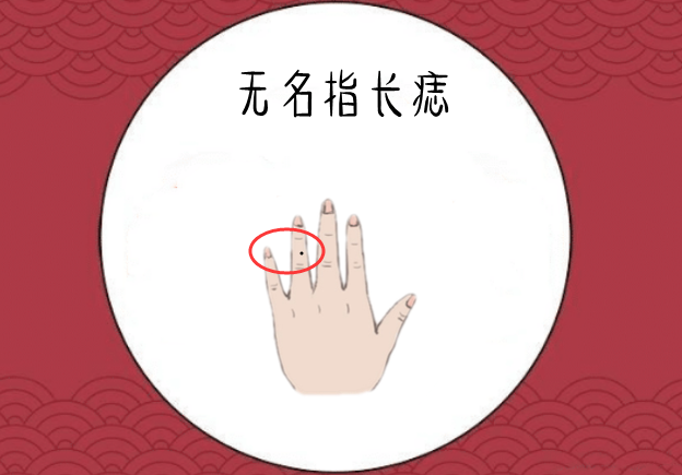 无名指长痣