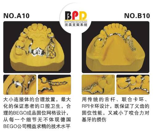 口腔可摘局部义齿支架设计大全
