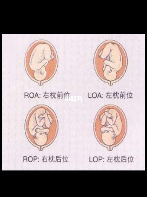 36 4右枕后位,不知道能不能顺产_顺产_孕期日记_母婴
