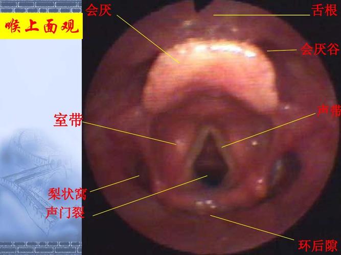 会厌 舌根 会厌谷 喉上面观 室带 声带 梨状窝 声门裂 环后隙