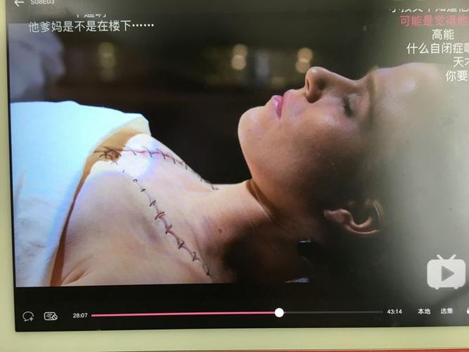 美剧中好多尸体上都有缝合线,那是什么?