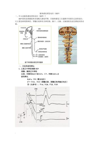 体感诱发电位