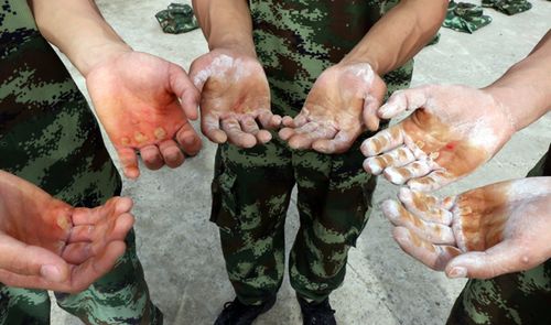 重庆90后武警战士一手老茧,掉皮见肉让人心疼