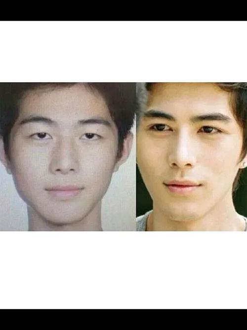 割了双眼皮之后倒是帅气了不少.