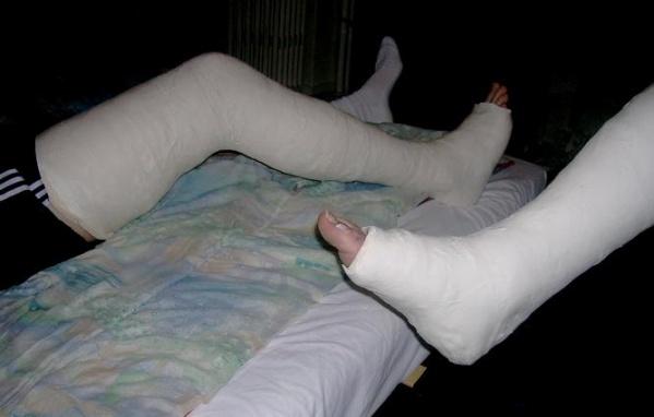 无菌超强型一次性熟石膏绷带 查看商品详情>