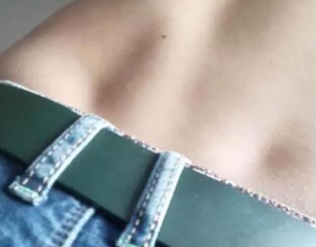 女人后腰上两个凹点是什么为什么仅有3的人有你知道吗