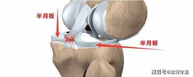 有利于半月板磨损自愈的方法