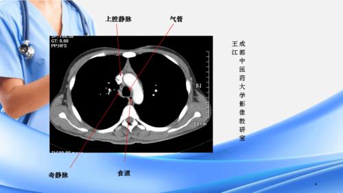 肺部ct肺部纵隔窗(精选干货)