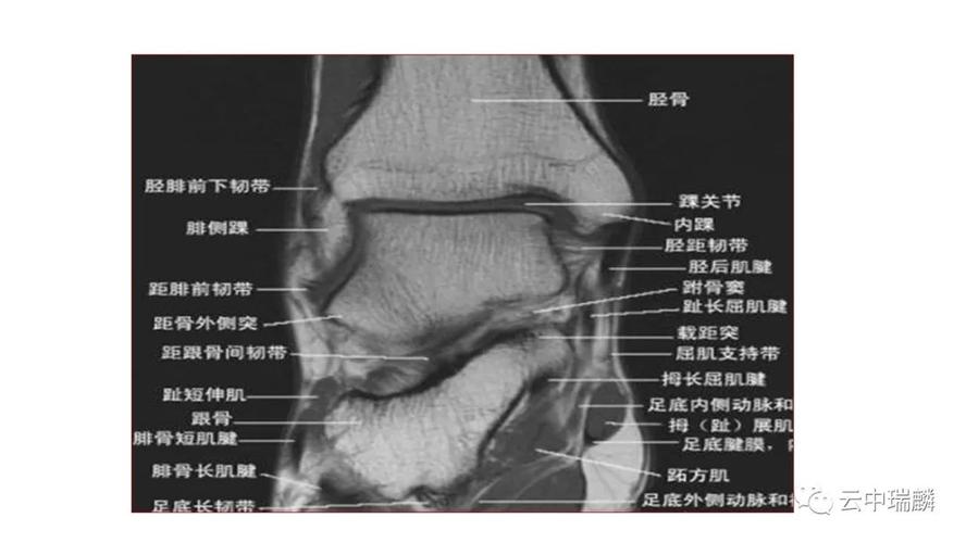 跗骨窦的解剖及临床意义