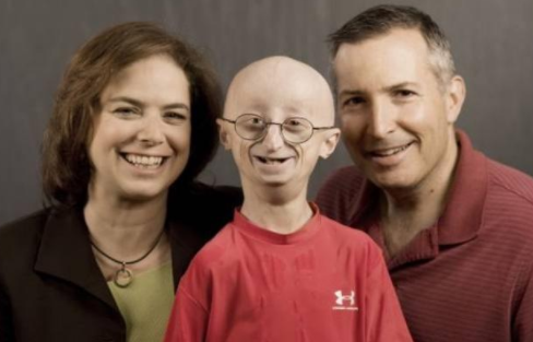 原创多活了4年!美女患早衰症后活到19岁,她的人生开了5倍速