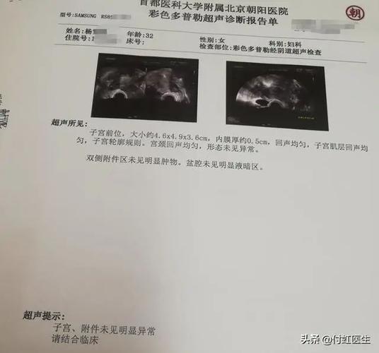b超检查子宫内膜回声不均我到底得了什么病