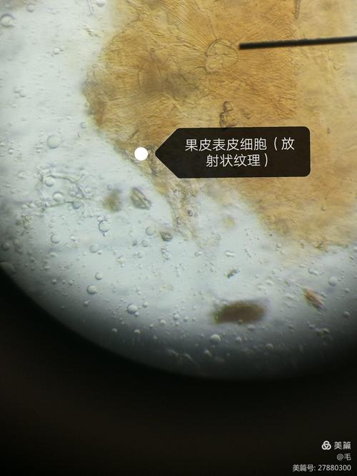 五味子显微特征