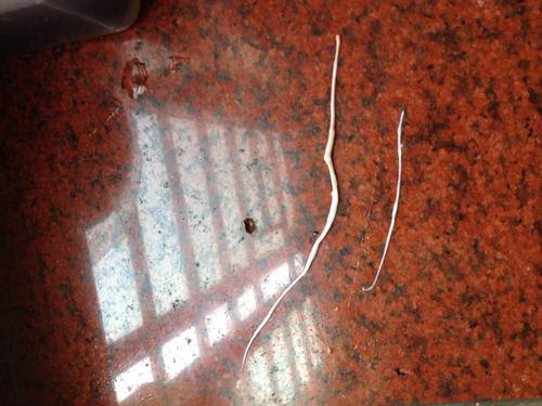 在猪肉里面弄出来的,请问这个是什么?是虫子还是筋?