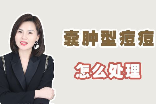 囊肿结节型痘痘要怎么处理预防大于治疗