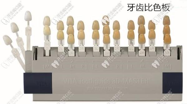 全瓷牙比色板