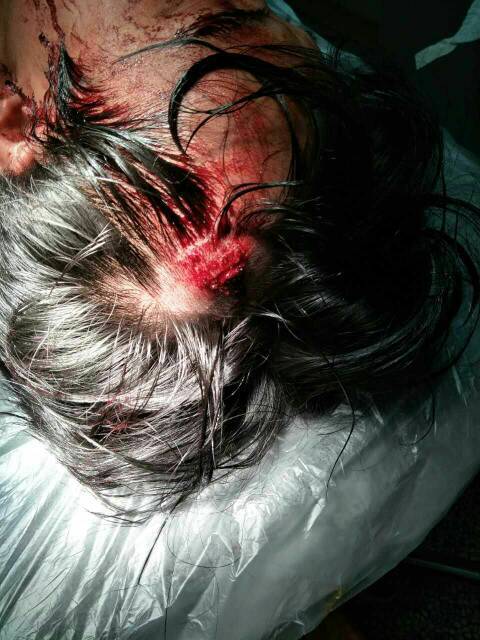 我被十几个人打了,头被打破住院了,打我的人跑了,我报警半个小时之后