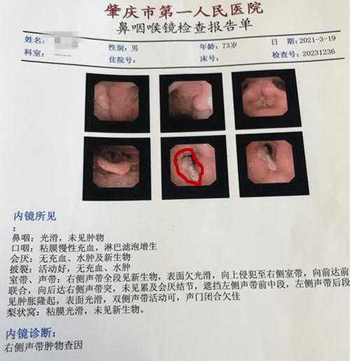 肇庆一院耳鼻咽喉