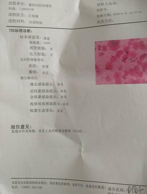 做了宫颈癌筛查!这个结果表示什么?