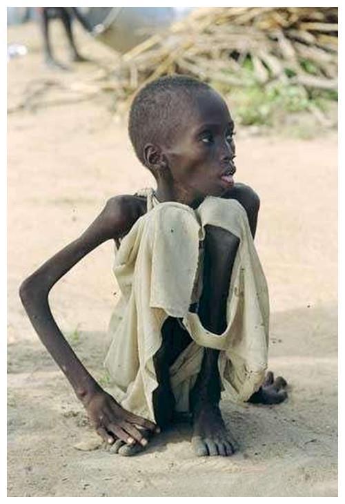 卡特可以赶走那只等候小女孩死亡的秃鹫,但是还有千千万万只秃鹫又有