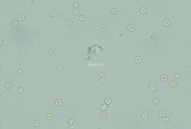 肺泡灌洗液细胞学检查只需看细胞吗