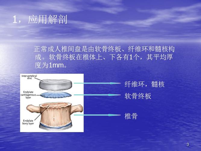 椎体终板炎ppt演示幻灯片