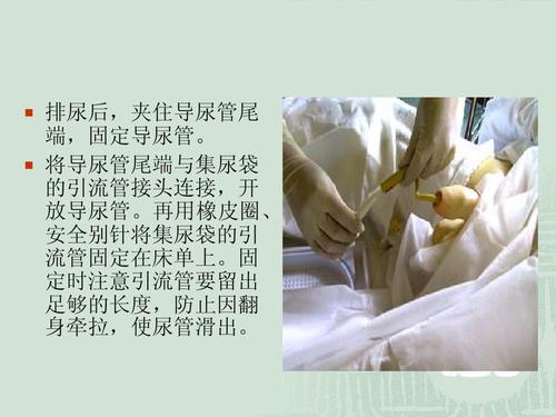 留置导尿术ppt