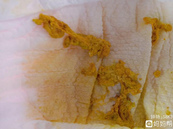 宝宝10天了这几天便便老是奶瓣而且一