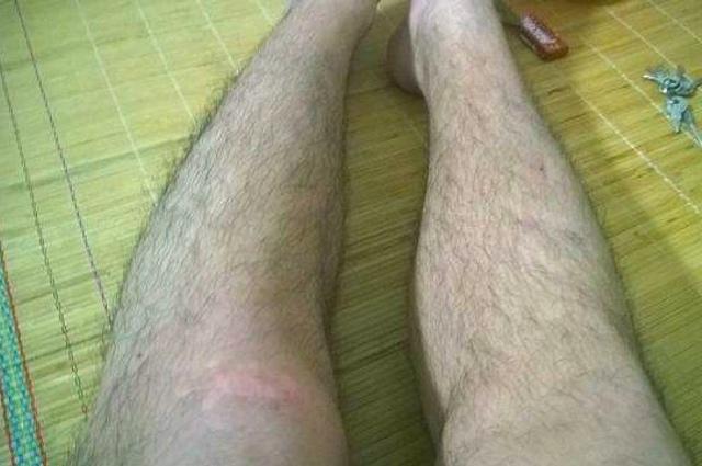 为什么有的男生"满腿"毛,有的毛发很少?看完涨知识