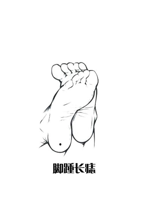 相学解析  ( 1/ 6) 分享到责编:董莉莉                  脚踵长痣 这
