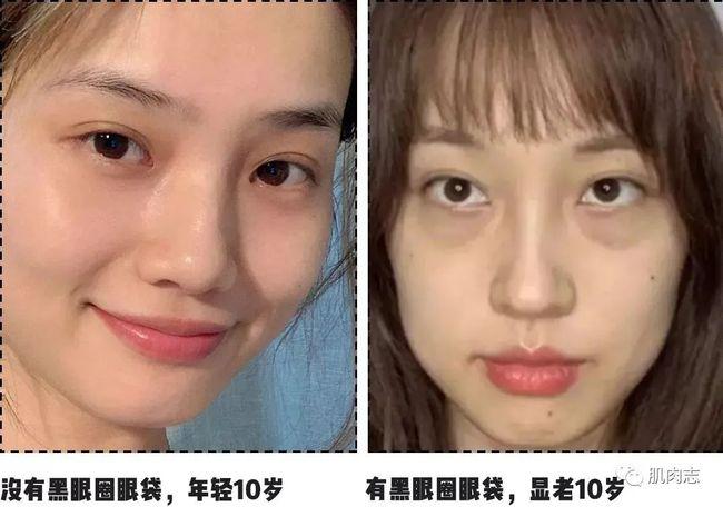 熬夜一年身体前后变化再也不敢熬夜了