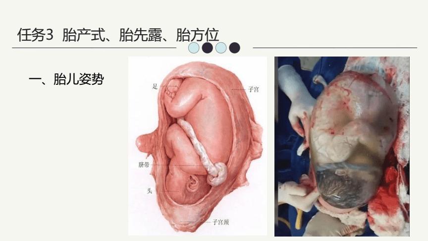胎产式,胎先露,胎方位(14页)-原创力文档