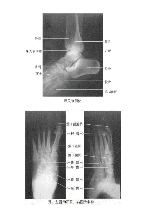 足部x光及解剖图.docx