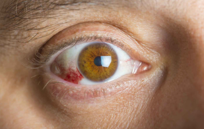 瞳孔放大意味着什么