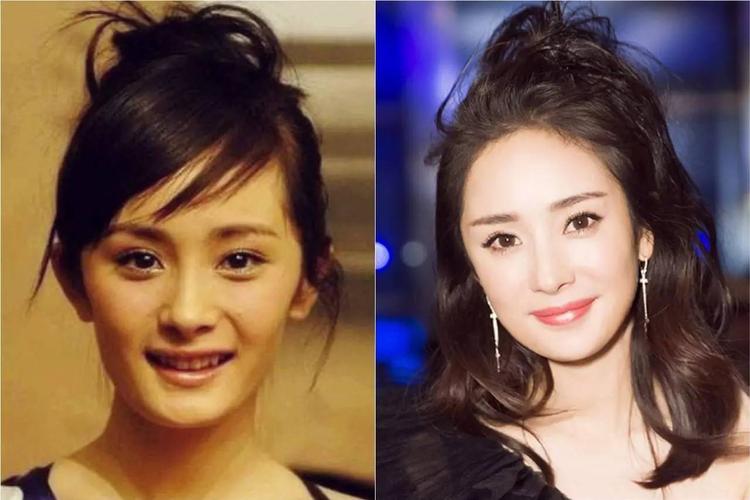 很多女生都存在太阳穴凹陷以及颧骨外扩的问题,最简单的判断方法就是