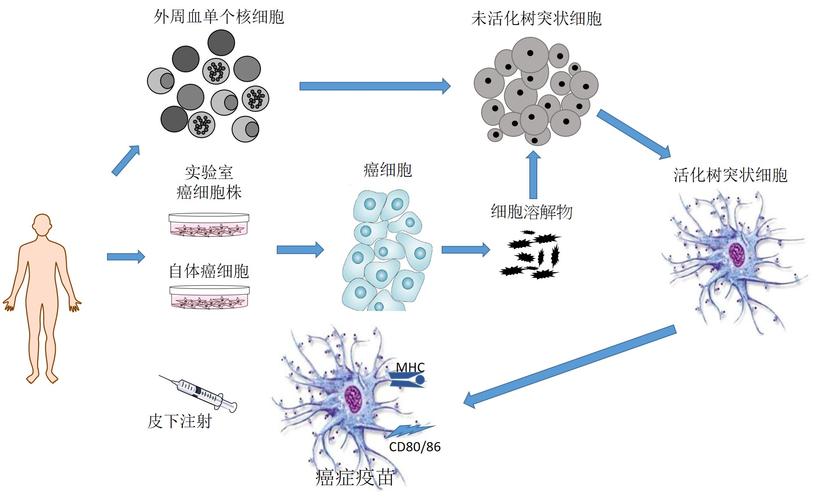 深圳市免疫基因治疗研究院展开dc疫苗治疗脑癌