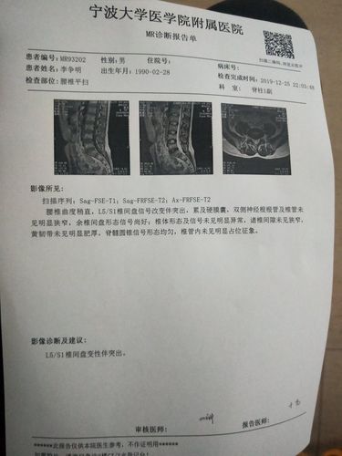 请大神看下磁共振腰椎有没有突出,有没压迫神经?